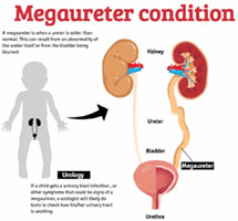 10-year-old Boy from Myanmar with a Congenital Urinary Tract Defect, Cured by Kauvery Hospital